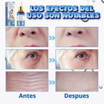 Botox Stock Solution Suero antiarrugas 2 X 1 Compra 1 y tellevas 2 🎁