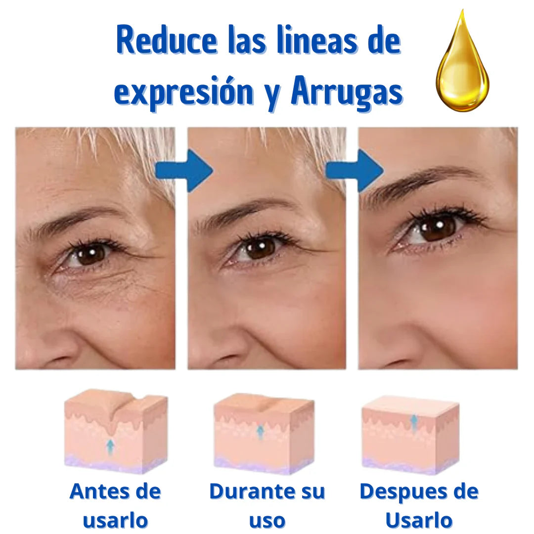 Paga 1 Lleva 2 Botox Stock Solution Suero Antiarrugas + REGALO
