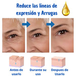 Paga 1 Lleva 2 Botox Stock Solution Suero Antiarrugas + REGALO