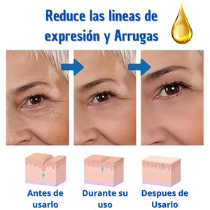 Paga 1 Lleva 2 Botox Stock Solution Suero Antiarrugas + REGALO
