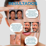 Paga 1 Lleva 2 Botox Stock Solution Suero Antiarrugas + REGALO